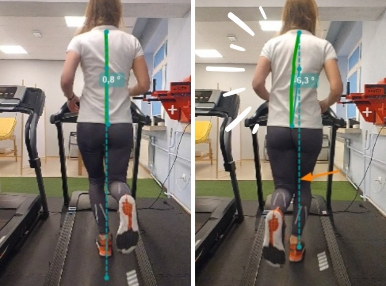 Move Improve Fizjoterapia Sportowa
